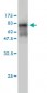 DMRT1 Antibody (monoclonal) (M01)